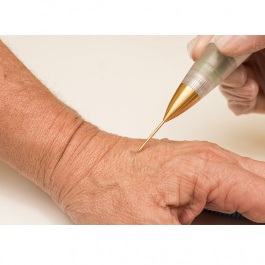 Jett Plasma Lift Medical- Lifting Corporal e Facial, intervenções dermatológicas e pequenas cirurgias Celebrim - 10