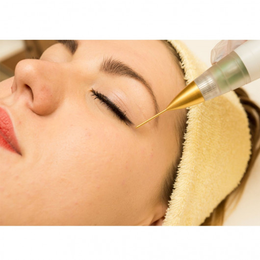 Jett Plasma Lift Medical- Lifting Corporal e Facial, intervenções dermatológicas e pequenas cirurgias Celebrim - 8