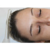 Combo - Alta Frequência HF Ibramed + Kit de Eletrodos - Tratamentos Faciais e Capilares - 4