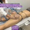 Vacum Laser MMO - Aparelho de Vacuoterapia e Fototerapia - 6